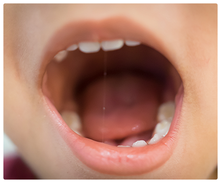 発音・発語練習